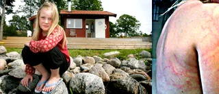 Ella träffades av blixten