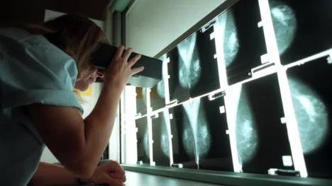 Bröstcancer är den vanligaste cancerformen bland kvinnor. Varje år dör cirka 1 500 kvinnor i Sverige av sjukdomen. Tack vare ett forskningsprojekt i Norrbotten kan en effektiv metod för att förebygga bröstcancer bli verklighet.FOTO: Fredrik Sandberg/SCANPIX