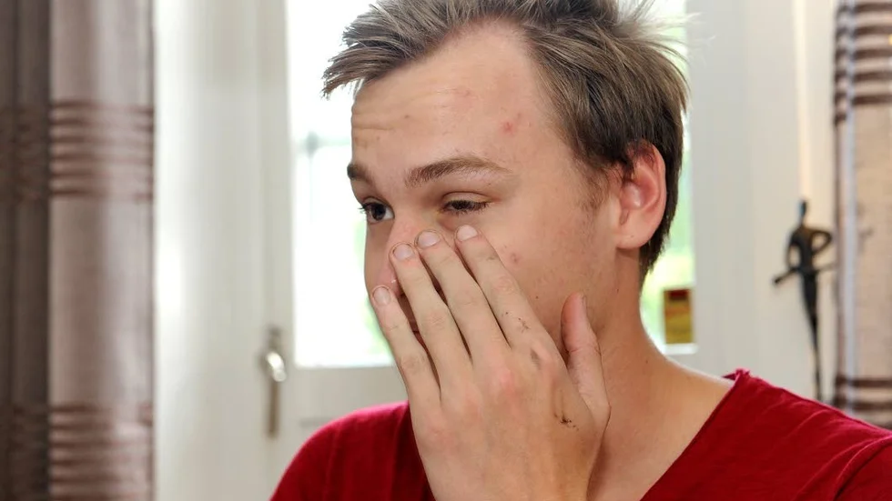 Parasit. Alex Eidersjö har permanent nedsatt syn på vänster öga.