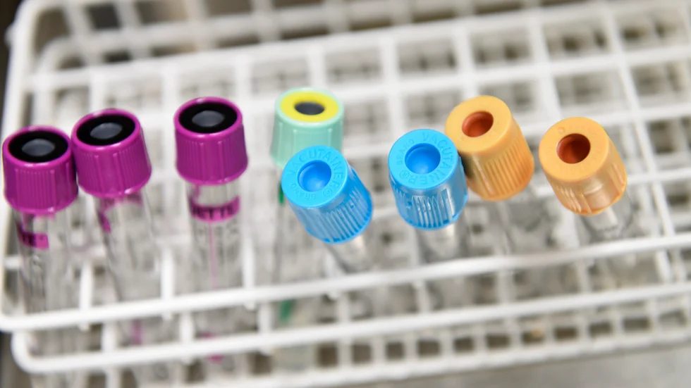 "Det var dålig uppföljning när prover hade tagits och den medicinering han ordinerades fungerade inte och följdes inte upp", skriver insändarskribenten och undrar hur man säkerställer att rätt vård ges när det behövs.