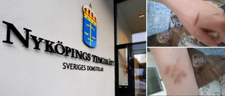 Kvinna brände sitt offer med cigarett – åtalas för våldsam attack