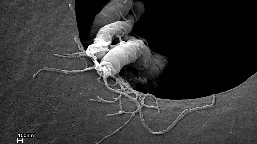 Helicobacter pylori-bakterier så som de ser ut i elektronmikroskopets förstoring.
