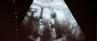 Aborträtten är inget för grundlagen