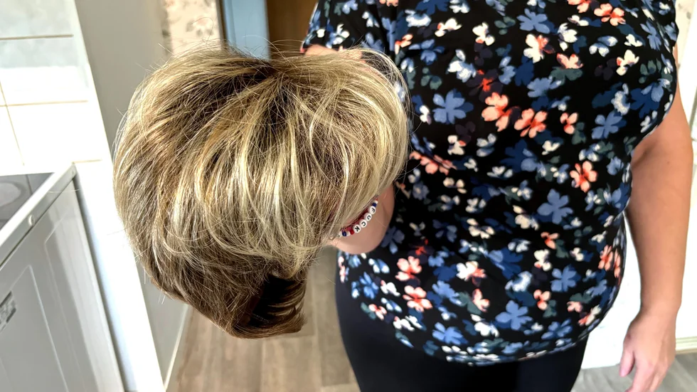 ”Uppmanar alla patienter att reagera på saker som inte känns bra - vi äger”, skriver Patient med håret på väg tillbaka som är glad för de nya reglerna för gotlänningar som behöver peruk. 