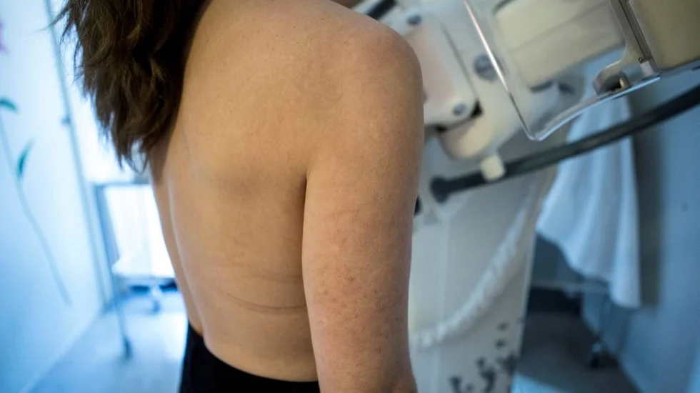 Trots att mammografin nu är gratis uteblir lika många kvinnor som innan avgiftsfri undersökning infördes. (Arkivbild)