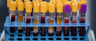 Uppmärksammad antikroppsstudie anmäld