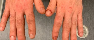 Gästarbetarens svar på blodiga misshandeln av arbetskamraterna: ”Tjatat i sex veckor att jag inte vaccinerat mig”