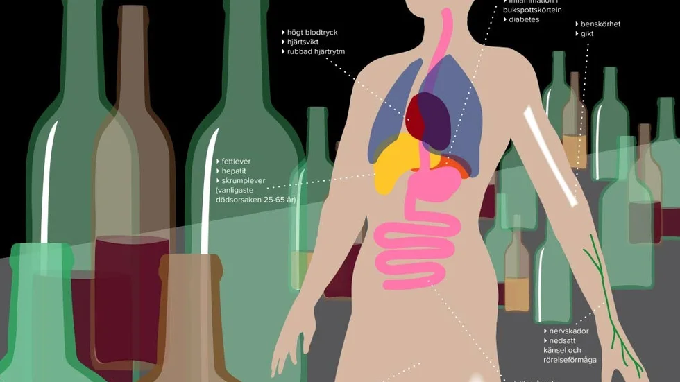 Så skadas kroppen. Stora mängder alkohol går hårt åt det inre organen, största smällen tar levern. Här ser du de vanligaste skadorna. Grafik: Maria Lindgren