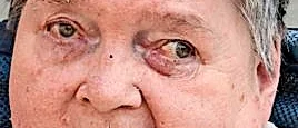 Hjördis Bergmark