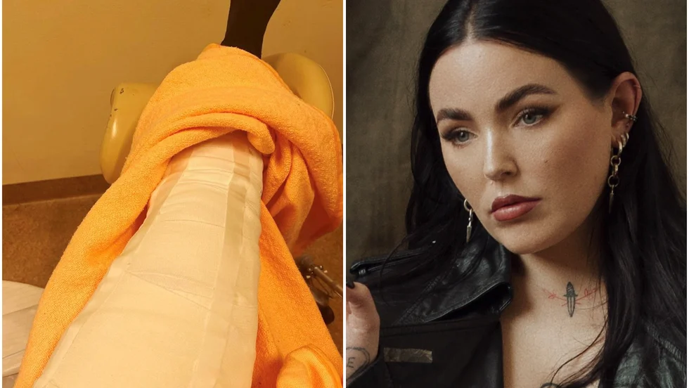 Miriam Bryant bröt benet i en skidolycka i Åre under helgen. Bilden till vänster är publicerad på artistens Instagram-sida.