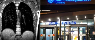 Sjukhuset missade lungcancer