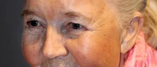 Alice Babs drabbad av stroke