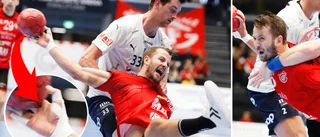 Ekman avslöjar: Spelar med skadad hand – tar smärtstillande