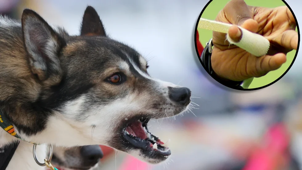 Mannens hund bet en annan man i fingret. Nu åtalas han för vållande till kroppsskada. Bilderna på hunden och fingret är tagna i andra sammanhang.