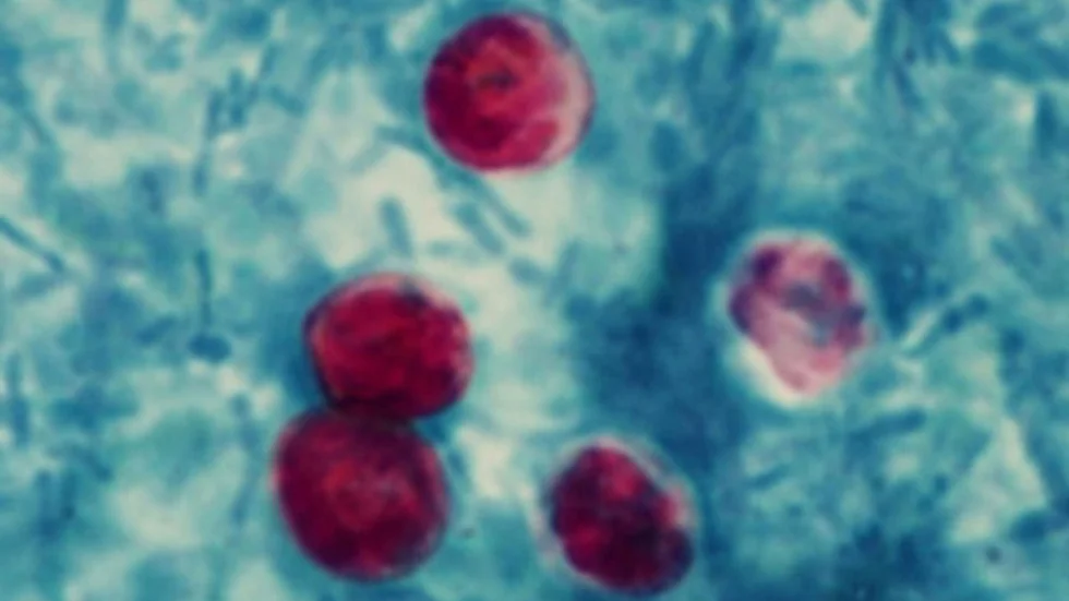 Cryptosporidium-parasiten. Foto: Smittskyddsinstitutet