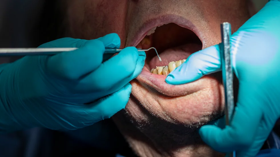 Tandvårdsbolaget My dentist blir av med sitt statliga tandvårdsstöd. Arkivbild.