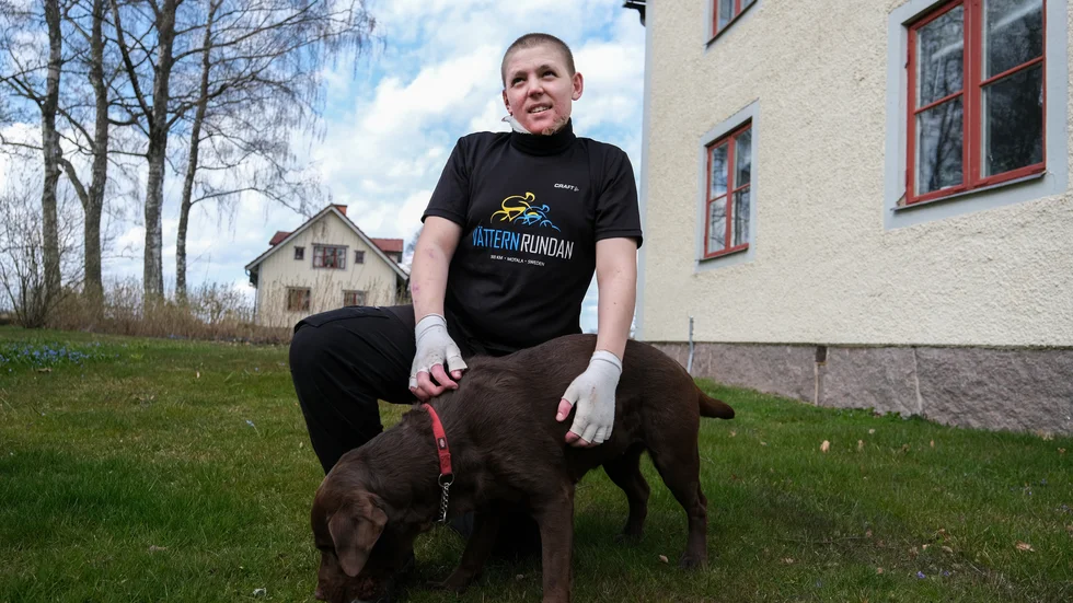 Erik Lönneskog har åldern på sin sida och rehabiliteringen går snabbt. "Vem bryr sig om några ärr?" frågar han sig.