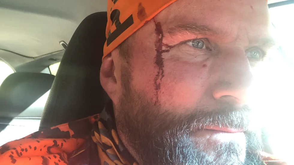 Hans Wiklund från Piteå revs blodig när han attackerades av en björnhona med två ungar.