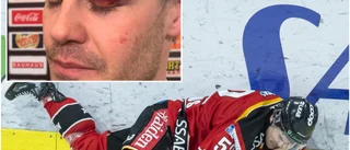 "Fabbe" reste sig på 9 – gick på knock tre stygn senare: "Inte så farligt"