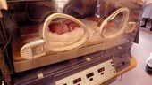 En liten flicka bara två veckor gammal sondmatas i en av kuvöserna på barnkliniken i Norrköping.
FOTO: ANITA KJELLBERG