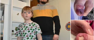 Sam, 7, har haft ont i månader – väntat på operation: "Det har varit som en mardröm"