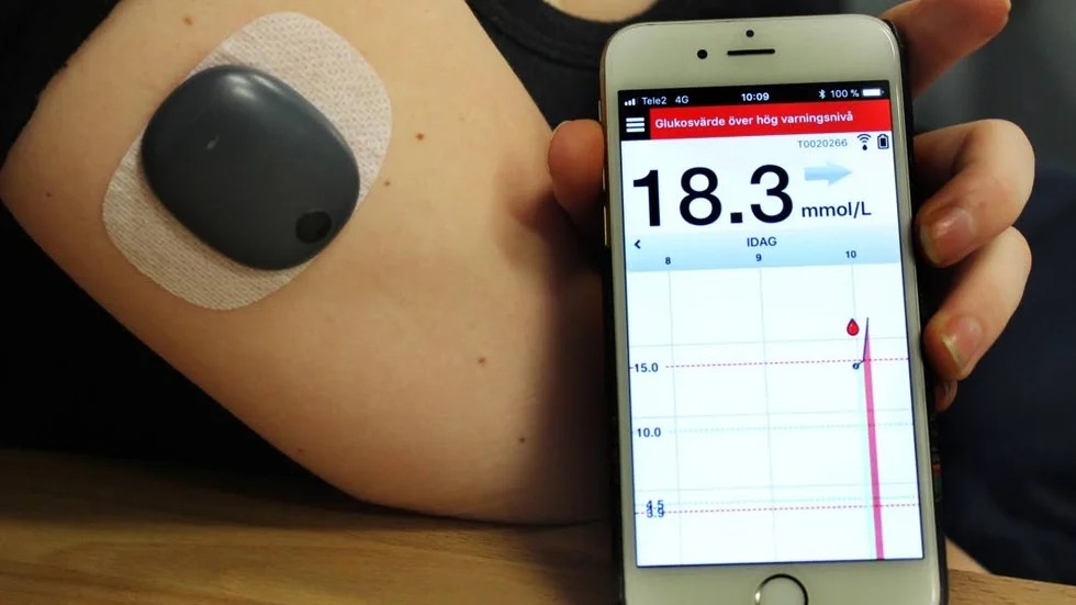 En sensor som rapporterar blodsockret till en app är ett hjälpmedel som vissa diabetiker har tillgång till. Andra får klara sig med beydligt enklare metoder, påpekar skribenten.