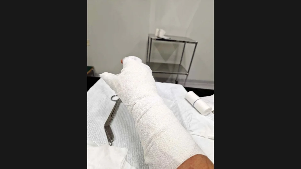  Rungnapa Rampadcha fick vårdas i sex timmar på akuten i Pajala efter olyckan.