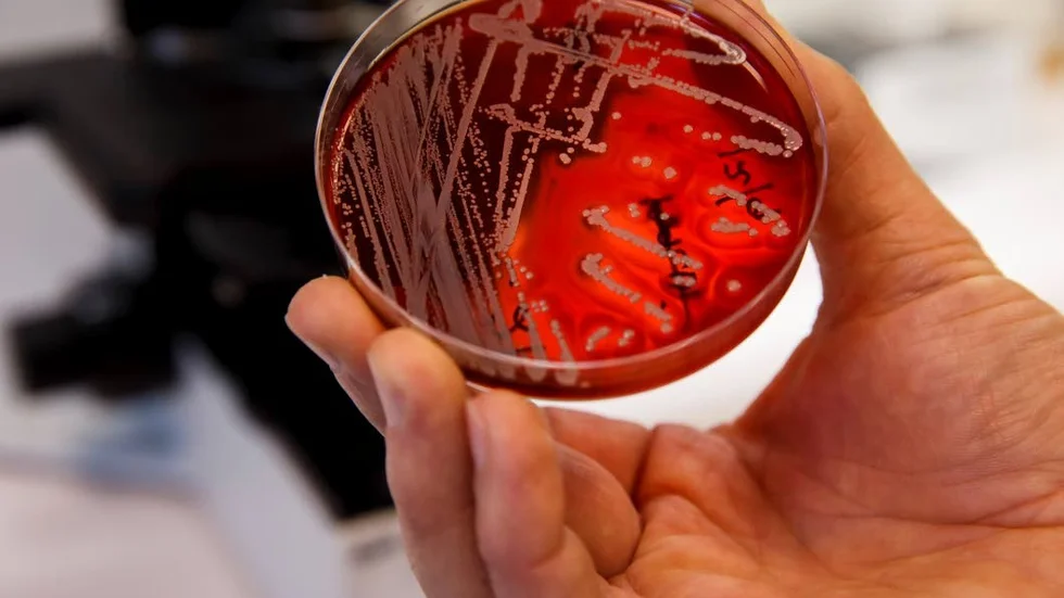 Antalet smittade av multiresistenta bakterier har ökat kraftigt i länet. (Arkivbild)