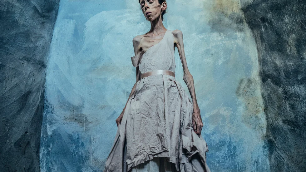 Fotografen Lene Marie Fossen har haft anorexia sedan hon var tio år. I början av "Självporträtt" är hon 28 år och fortfarande svårt sjuk. Pressbild.