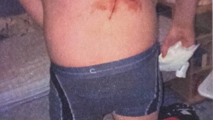 Brutalt. Med en kniv skars ett kryss in i ryggen på den 17-årige ynglingen som hämnd för brandbombsattacken.