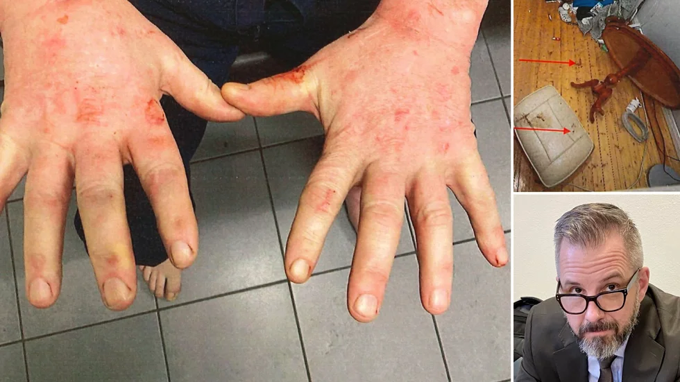 70-åringens blodiga händer, röran i bostaden efter det grova våldsbrottet. På onsdagen mötes mannen och kvinnan efter överfallet i huset den 14 januari. Det 38 minuter långa larmsamtalet var central bevisning som spelades upp för advokat Fredrik Björk (bilden) och övriga i rättssalen. 