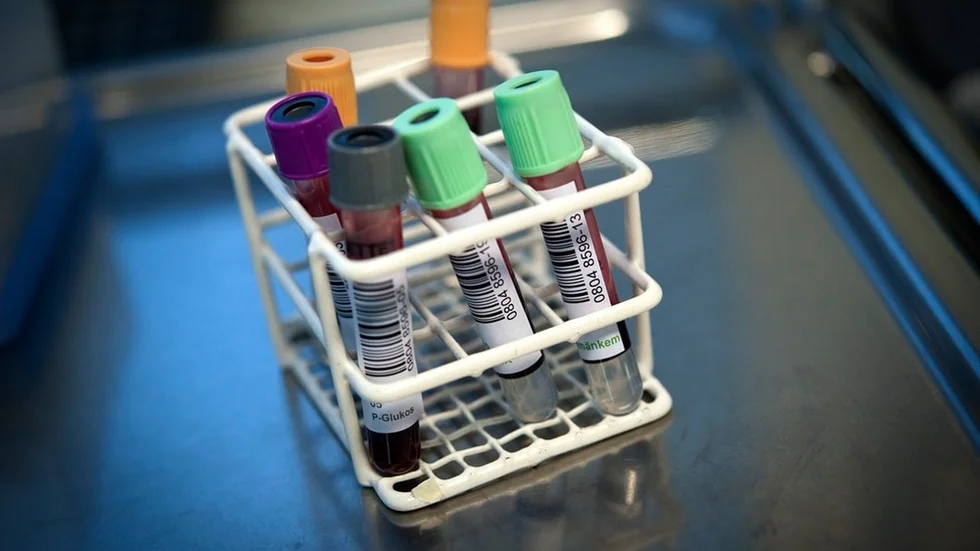 Näckrosbröderna, Patientföreningen mot prostatacancer i Sörmland, tycker att PSA-tester är bra.