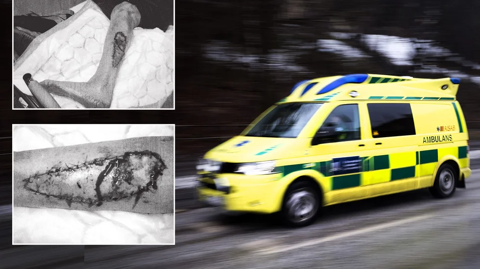 Mannen fördes med ambulans till sjukvård. Bilder ur förundersökningen visar skadan.