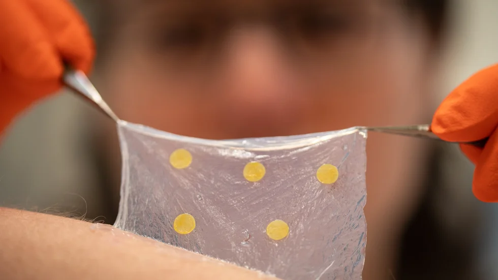Ett sårförband av nanocellulosa som kan skvallra om infektioner har utvecklats av forskare vid bland annat Linköpings universitet.