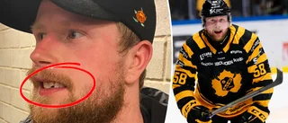 Nilsson fick tand sönderslagen: ”Vi gör något fel som inte får med oss utvisningar”