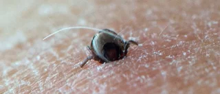 TBE dyrt för samhället – billigare med vaccin?