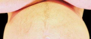 Man med mage riskerar testosteronbrist