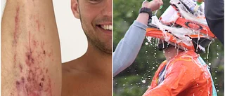 Dannes kamp mot klockan: Hinner armbågen läka?