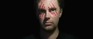 Tim Bergstedt om när livet förändrades över en natt 