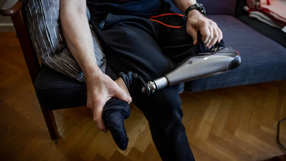 Patienten tvingades amputera underbenet. Bilden är en genrebild.