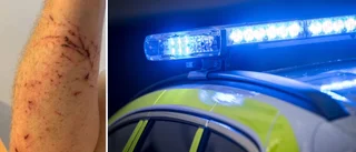 Attackerades med glasflaska – inne på krogen