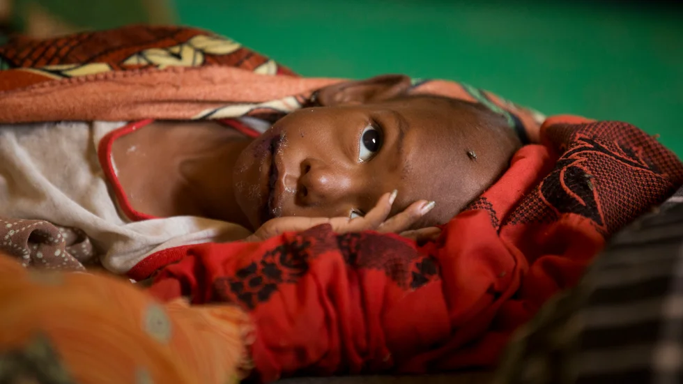 Hungersnöden riskerar att bli ännu värre i Sahelområdet, där länder som Tchad, Mali, Senegal och Burkina Faso är belägna.
