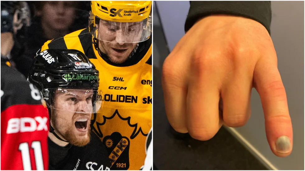 Brendan Shinnimin visar upp hur sitt lillfinger ser ut efter Filip Sandberg slashing i den tredje perioden. Det blev dock ingen utvisning på Skellefteåspelaren.