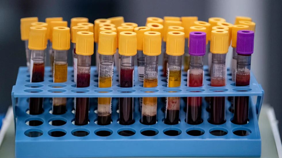 Blodprover som skulle kunna lagras i andra typer av biobanker än PKU-biobanken. Och som KD vill att brottsbekämpande myndigheter ska få tillgång till. 