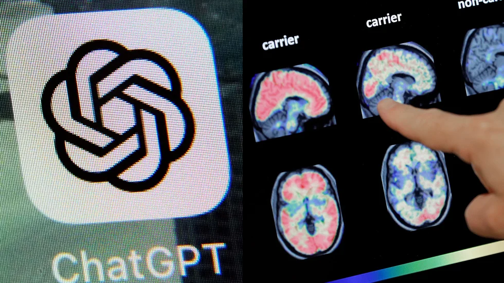 Dement AI? Enligt en ny studie uppvisar flera chattrobotar tecken på kognitiv nedsättning. Arkivbilder.