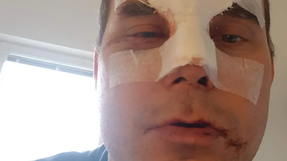 Karl Aikio är opererad och omplåstrad. Efter operationen har han dock inte satt sig i sulkyn igen. "Nu väntar jag på att benbitarna ska växa ihop innan jag kör igen" säger han.